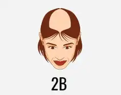 hair transplant treatment
