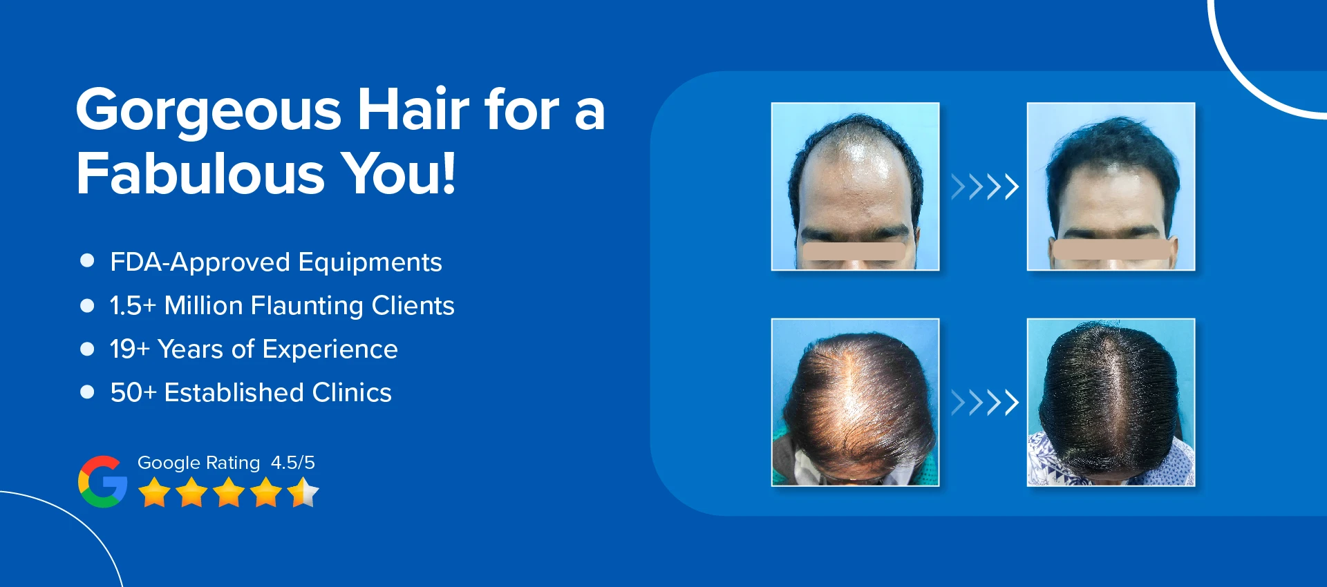 vcare transplantation treatment