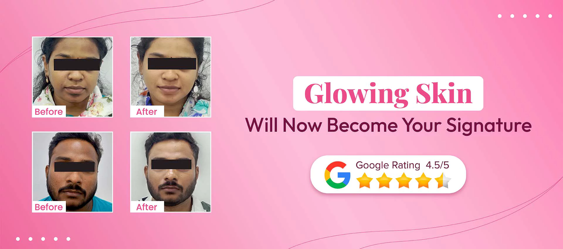 Laser Hair Removal  Treatment