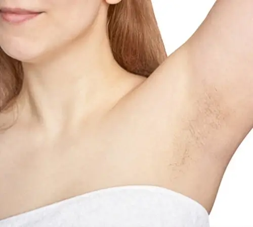Laser Hair Removal Treatment