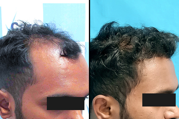 Hair Regrowth Clinic