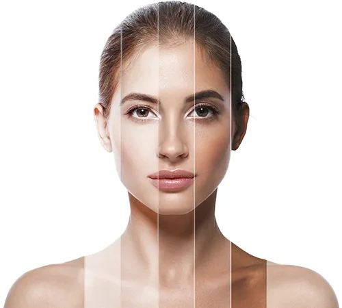 Laser Hair Removal Treatment